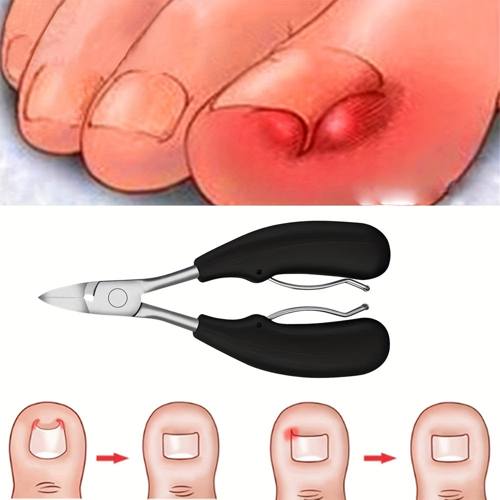 Kit da 4 pezzi di forbicine per unghie incarnite fisse per unghie spesse - Pelvicite per uso intensivo, lama in acciaio inossidabile con manico a presa facile - Ottimo per uomini e adulti, per regali di compleanno